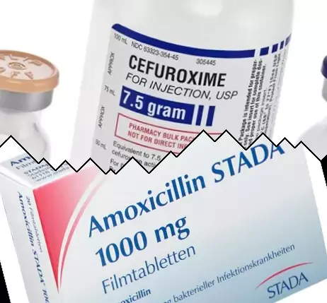 Cefuroxima vs Amoxicilina