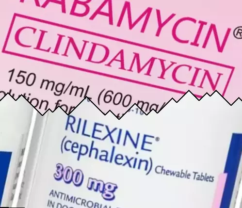 Clindamicina vs Cefalexina